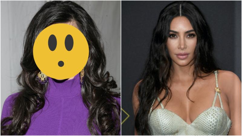 These Celebrities Are Unrecognizable After Plastic Surgery